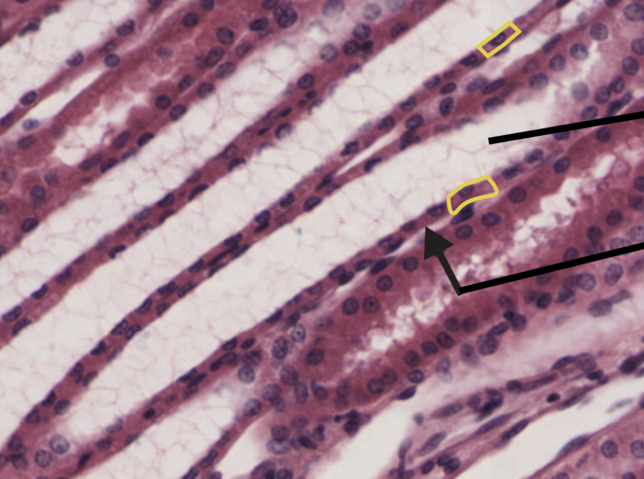 <p>This is a histology of what epithelium ?</p>