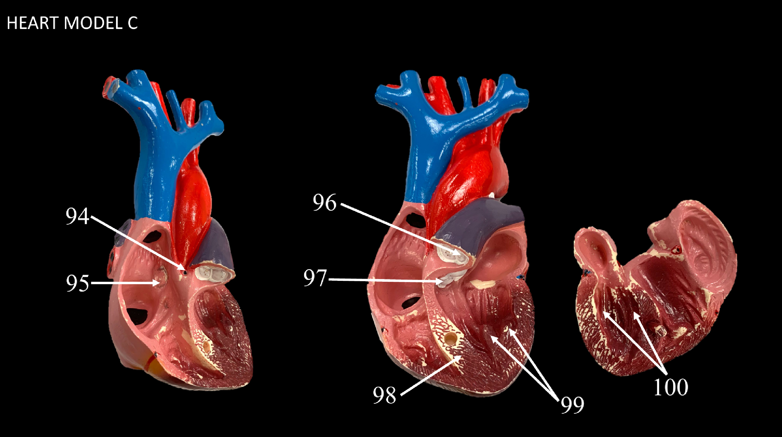 <p>WHAT IS 100 CALLED?</p>