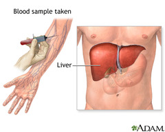 <p>blood tests can check liver function</p>