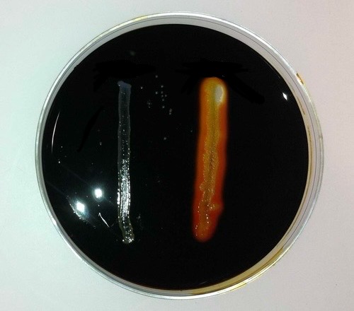 <p>What enzyme are you searching for with starch agar? </p>