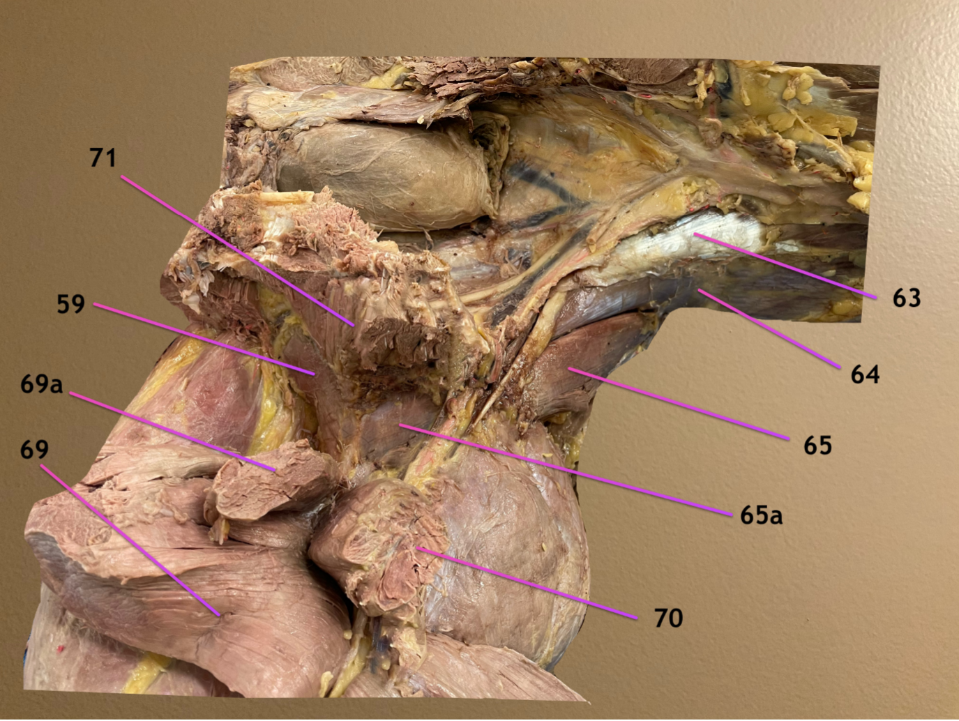 <p>ventral view of hip, horse laying on back, cranial to rt, left side of body toward bottom</p><p>.</p><p>label 59, 63, 64</p>