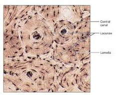 <p>other: bone (osseous tissue)</p>