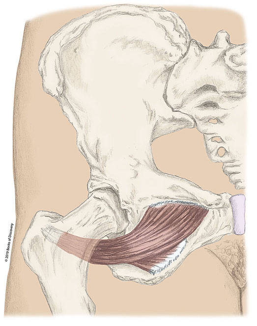 <p>obturator externus insertion</p>