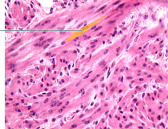 <p><strong>What is a characteristic of the highlighted muscle tissue?</strong></p>