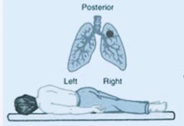 <p>What position is this?</p>