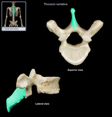 <p>Any bone prominence.</p>