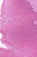 <p>Identify the tissue</p>