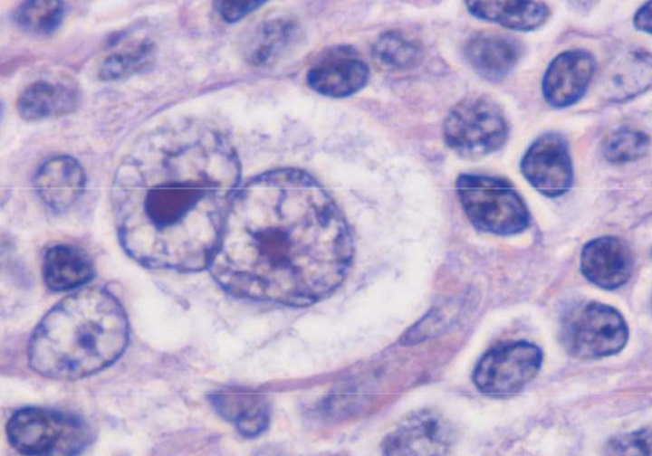 term image