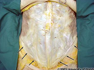 <p>what ligament is being indicated to in the image?</p>