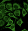 <p>cytoplasm lights up rather than nucleus</p>