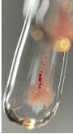 <p><span>A MLS observes numerous small agglutinates with a cloudy/turbid background after centrifugation. How should this reaction be graded?</span></p>