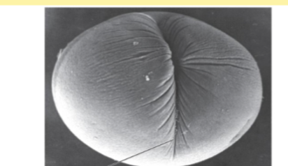 <p>Cleavage Furrowing </p>