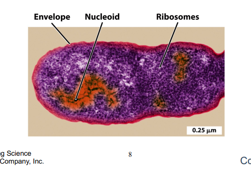 <p>Cytoplasm surrounded by cell envelope </p><p>¨Cytoplasm contains DNA in the nucleoid- a system of looped coils of DNA</p><p></p><p>heres the chromosome and most bacterial genomes are circular</p><p>surrounded to cell envelope which are specific to bacteria as only bacteria have cell envelopes which helps with making antibiotics targeting this</p>