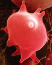 <p>hypertonic</p>