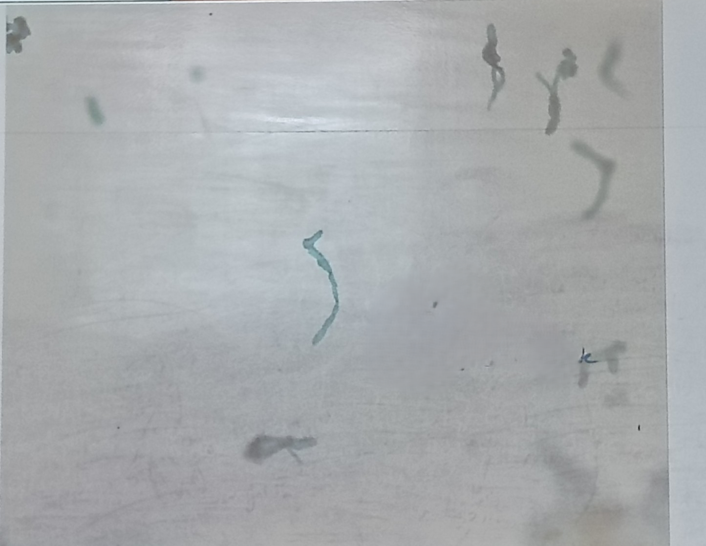 <p>Moss Protonema is the </p>