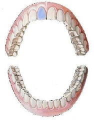 <p>maxillary right central incisor</p>