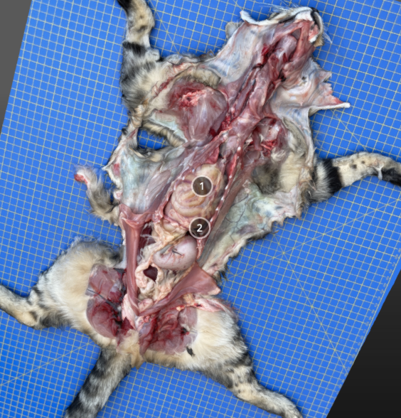 <p>Describe this herniation </p>