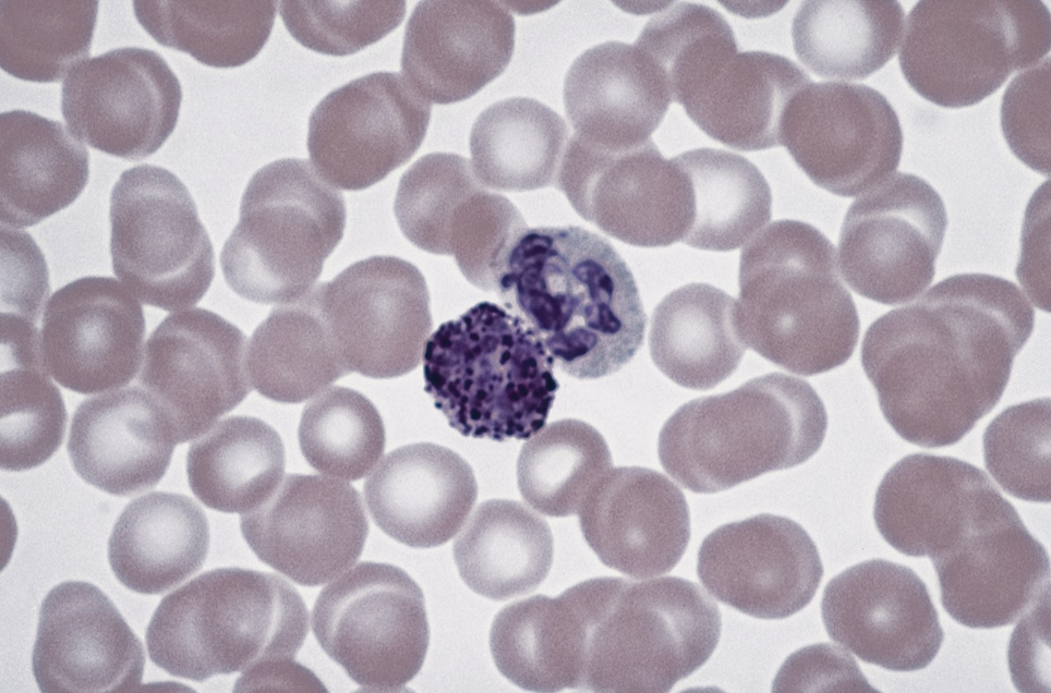 <p>ID white blood cells</p>
