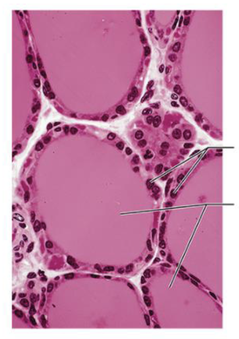 <p>What is this a slice through? </p>