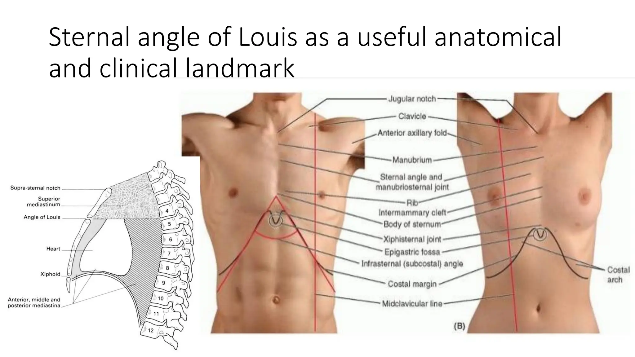 <p>Sternal angle</p>