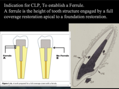 <p>To establish Ferrule</p>