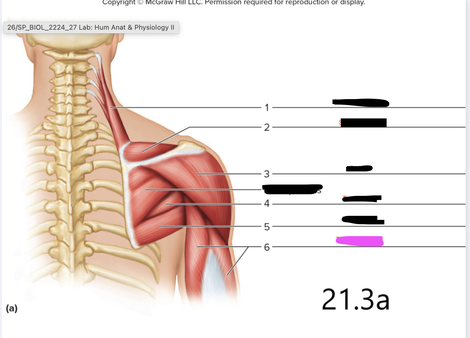 <p>Elbow - to move the forearm</p>