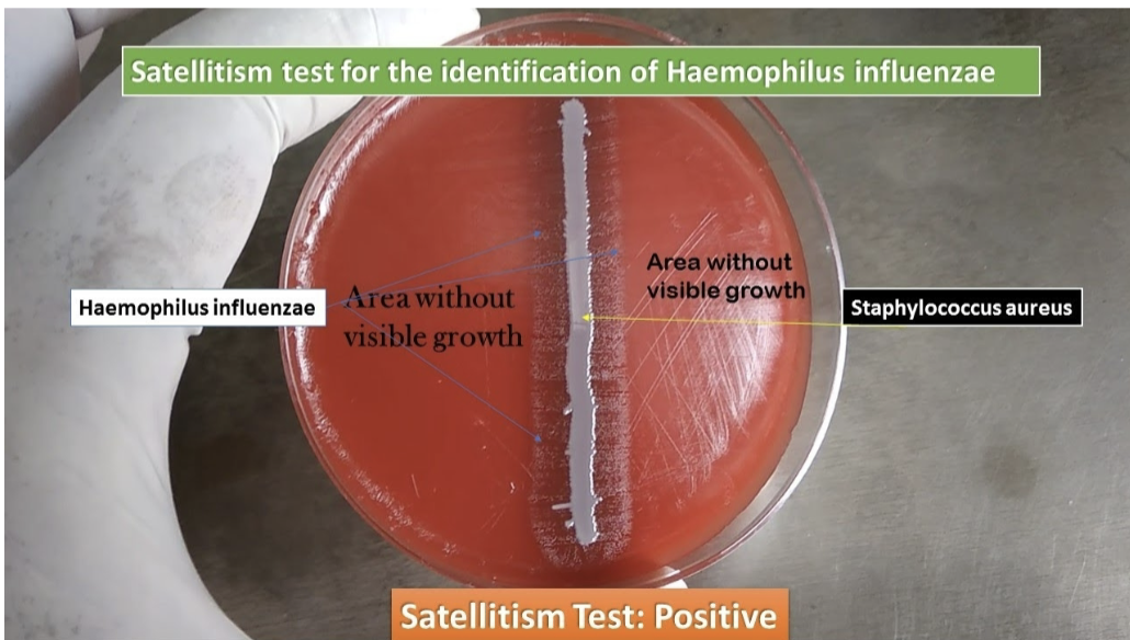<ul><li><p>Quad plate: </p><ul><li><p>requires X and V factors </p></li><li><p>NO hemolysis</p></li></ul></li><li><p>satellitism</p><ul><li><p>special characteristic </p></li><li><p>colonies will grow on SBA if a beta hemolytic S. aureus also present</p><ul><li><p>S. aureus releases X and V factors </p></li></ul></li></ul></li></ul><p></p>