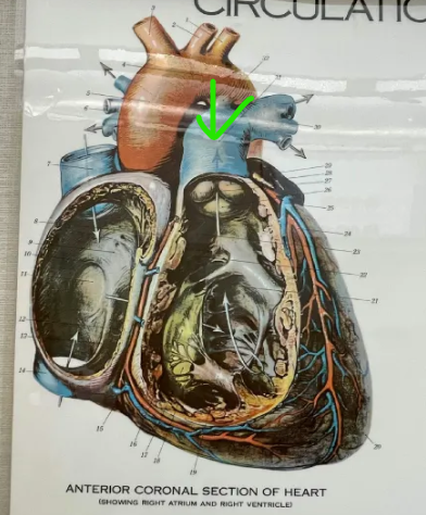 term image
