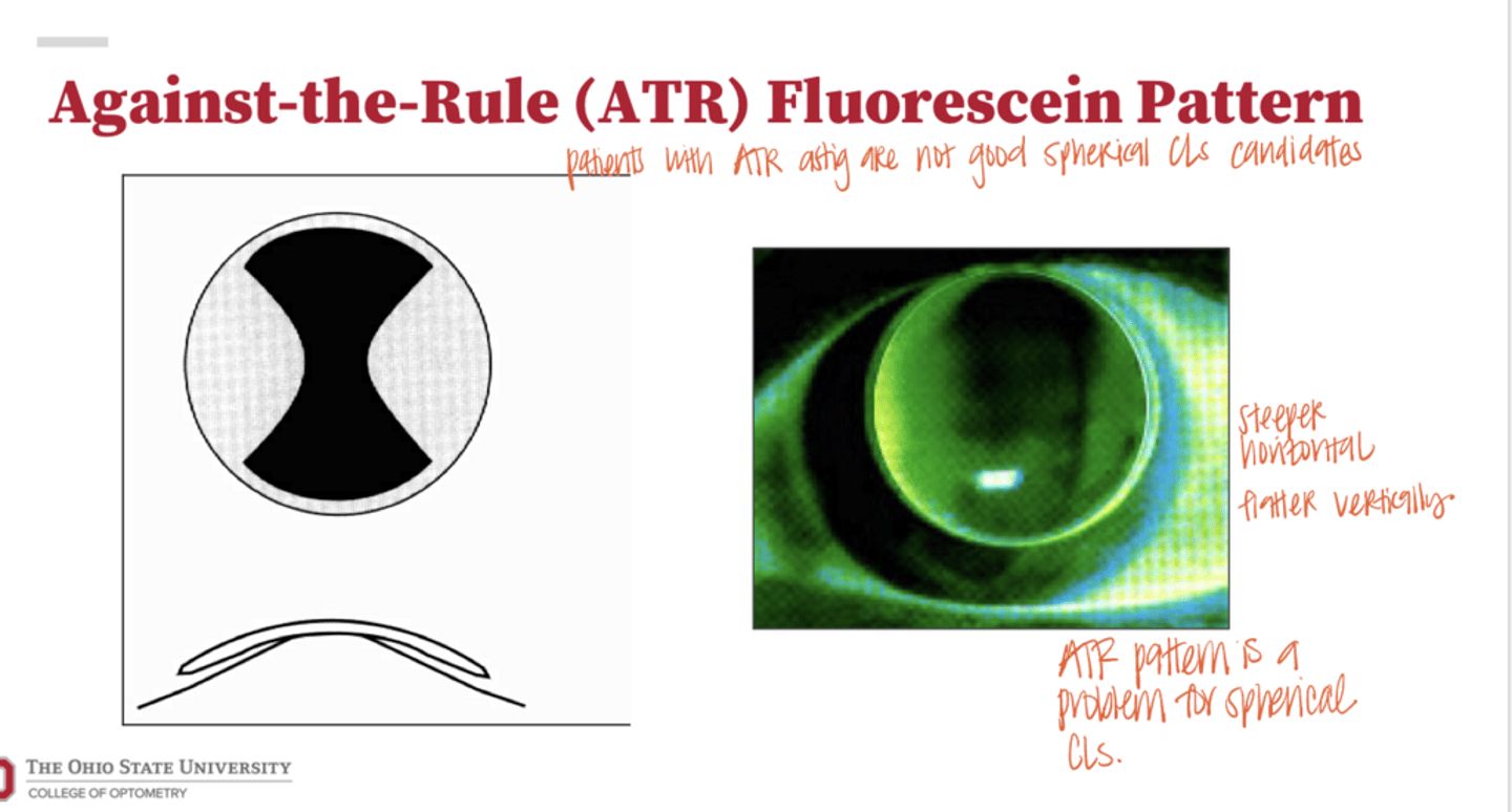 <p>Will an Against the Rule (ATR) fluorescein pattern also lid attach very easily?</p>