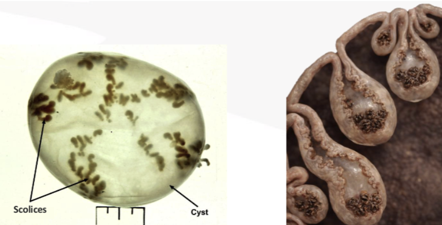 <p>What is this metacestode (larva) stage that contains many inverted scolices?</p>
