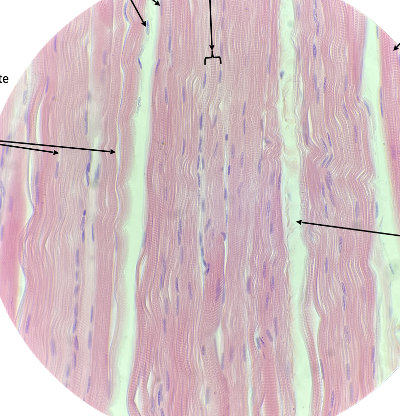 <p>Skeletal muscle tissue</p>
