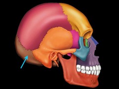 <p>What is this bone of the skull?</p>