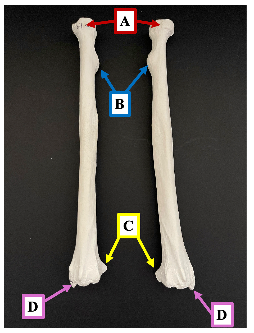 <p>Identify the bony landmark of the radius that label <strong>B </strong>is pointing to.</p>