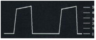 <p>What is this ETCO2 waveform</p>