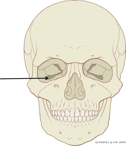 <p>eye area</p>