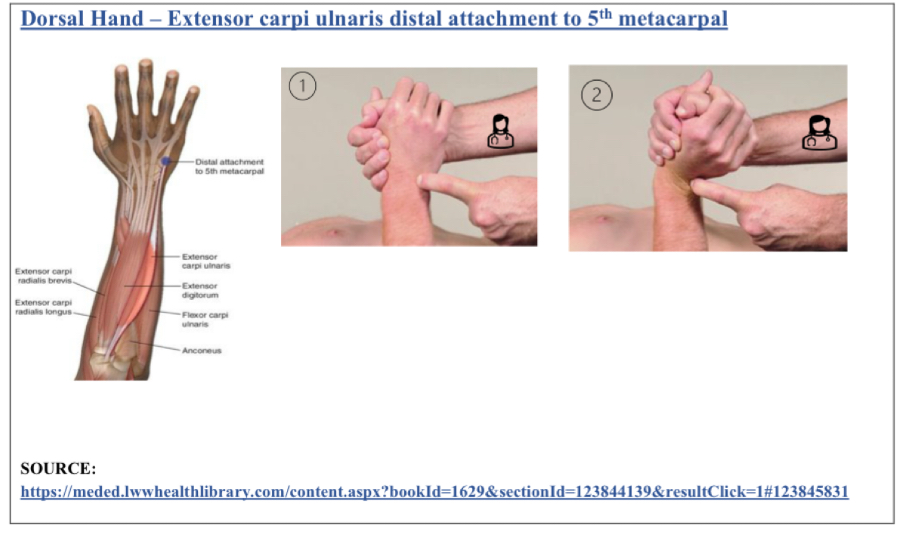 <p>Wrist extension, slight Add</p><p>dorsal surface of 5th MC joint in extensor carpi ulnaris muscle</p><ol><li><p>pt either seated or supine, physician faces pt</p></li><li><p>pt wrist extended and adducted (ulnar deviation)</p></li></ol><p></p>