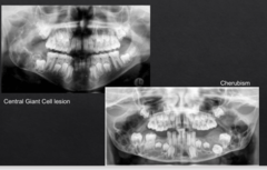 <p>Are these lesions localized or generalized?</p>