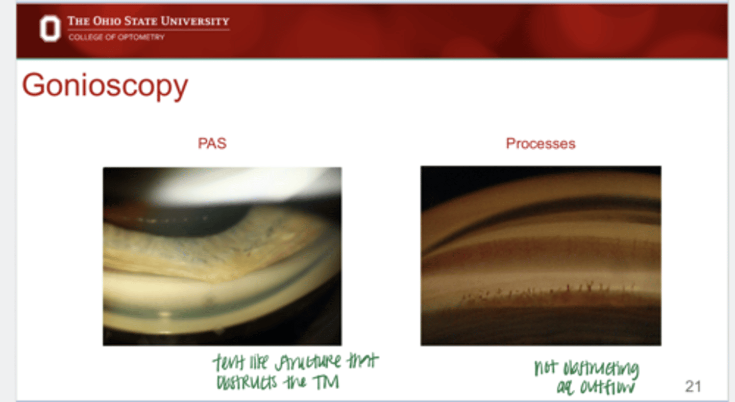 <p>PAS v Iris Processes (Pic)</p>