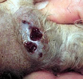 <p>Mycetoma</p>
