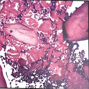 <p>1. Identify the problem shown in this image </p><p>2. List 2 ways that it could be prevented or corrected</p>
