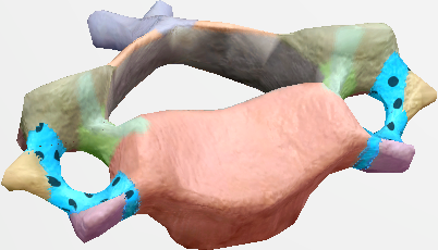 <p>(Hole)</p>