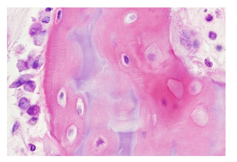 <p>A17) Below is a tissue preparation stained with haematoxylin-eosin. Name three different cell types that can be observed in this preparation.</p>