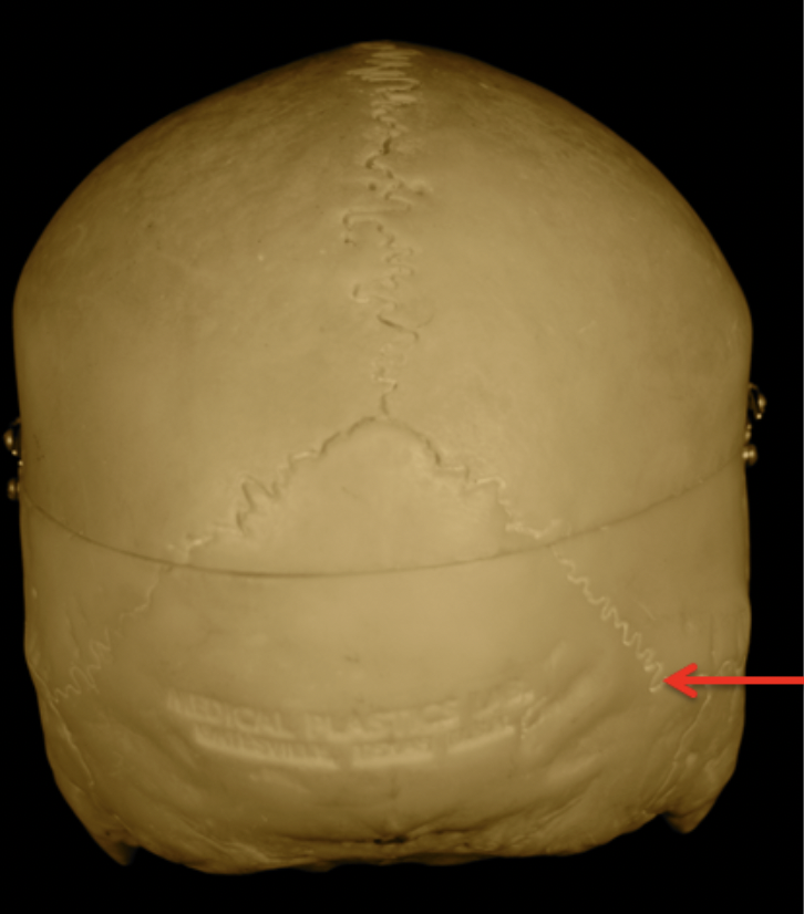 <p>Identify the arrowed structure. Be specific.</p>