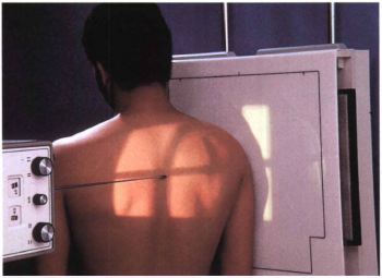 <p>The patient pictured here is said to be in the ___________ position;</p>