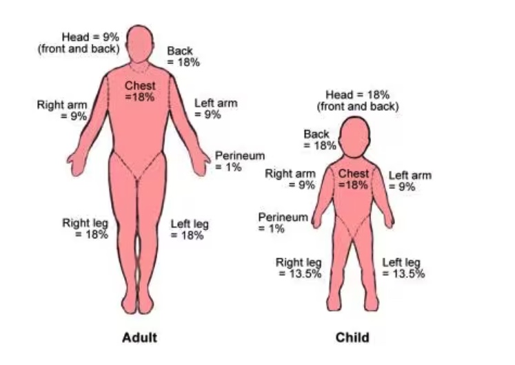 <p>a medical tool used to estimate the total body surface area (TBSA) providing a more accurate calculation than simpler methods like the "Rule of Nines," especially for children.</p>