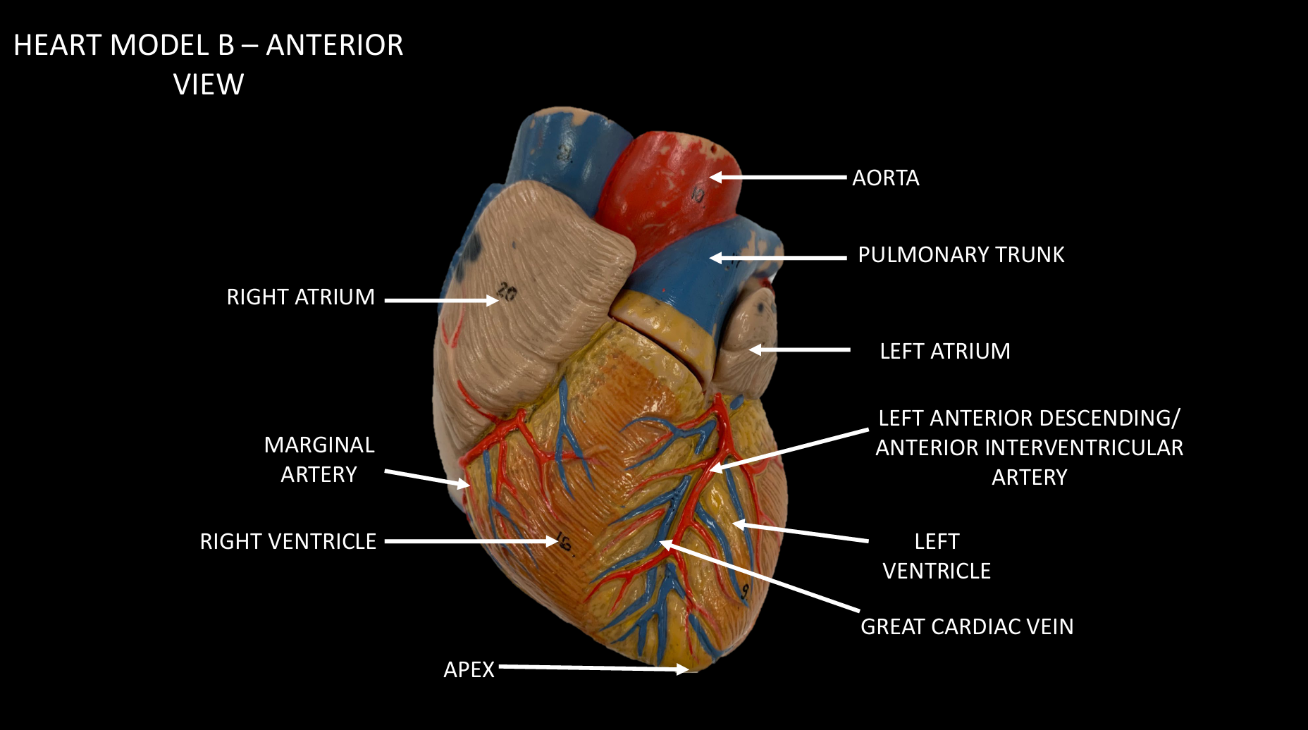 <p>RIGHT ATRIUM</p>