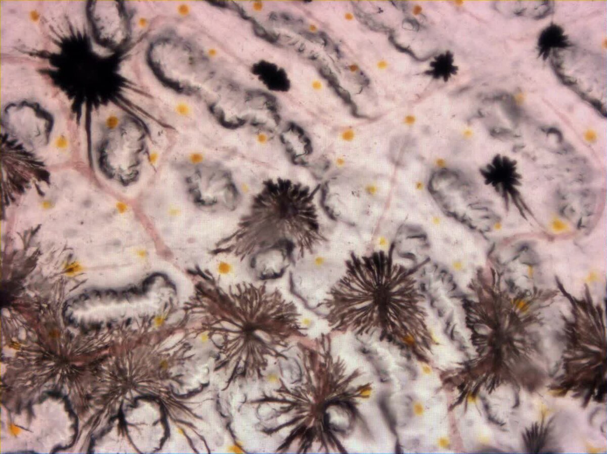 <ul><li><p><span>the "dark" pigment cells in the skin of reptiles, amphibians, and fish that are primarily responsible for </span>physiological color change</p></li></ul><p></p>