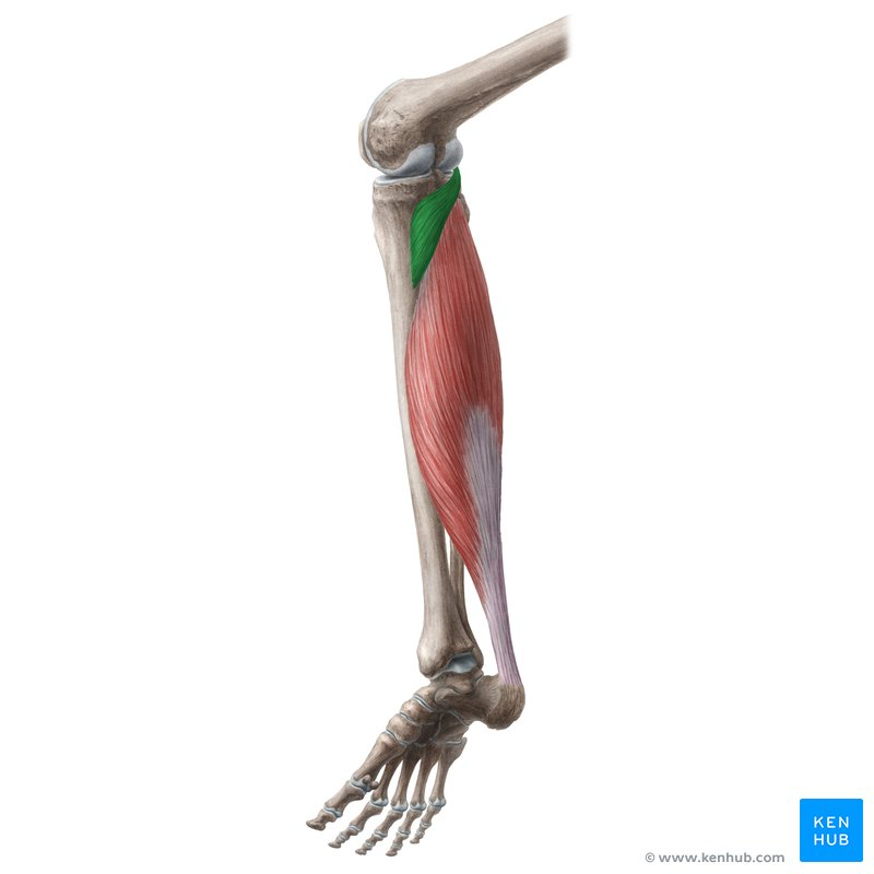 <p>Origin: lateral condyle of the femur</p><p>Insertion: proximal portion of the tibia</p><p>Action: flexes and rotates the leg medially</p><p>Nerve root: tibial (L5, S1)</p>