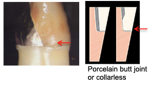 <p>Porcelain butt joint or collarless design</p>