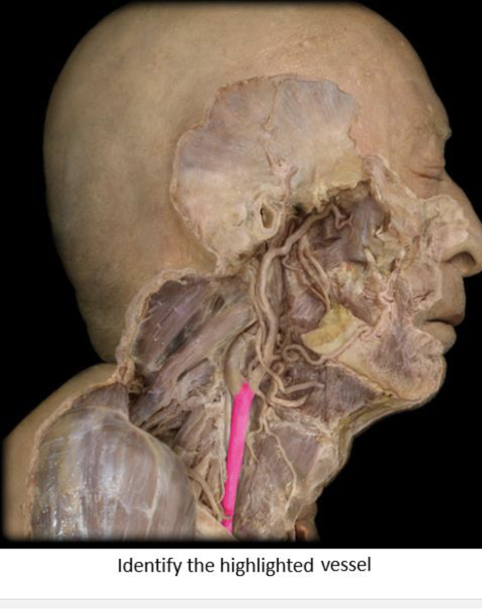 term image